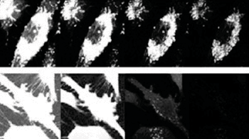 Imagen: Células de cáncer de mama humanas teñidas con triangulenio y un colorante de última generación. La serie de fotografías se obtuvo en un poco más de 30 nanosegundos. El triangulenio emite luz hasta durante 100 nanosegundos (Fotografía cortesía de la Universidad de Copenhague).